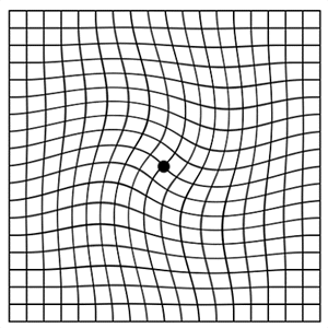 當線條或方格出現扭曲,歪斜或黑影則為異常現象