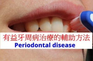 periodontal-disease-remedies