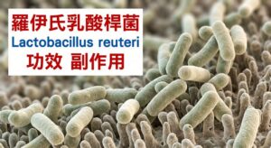 lactobacillus-reuteri-benefits-side-effects
